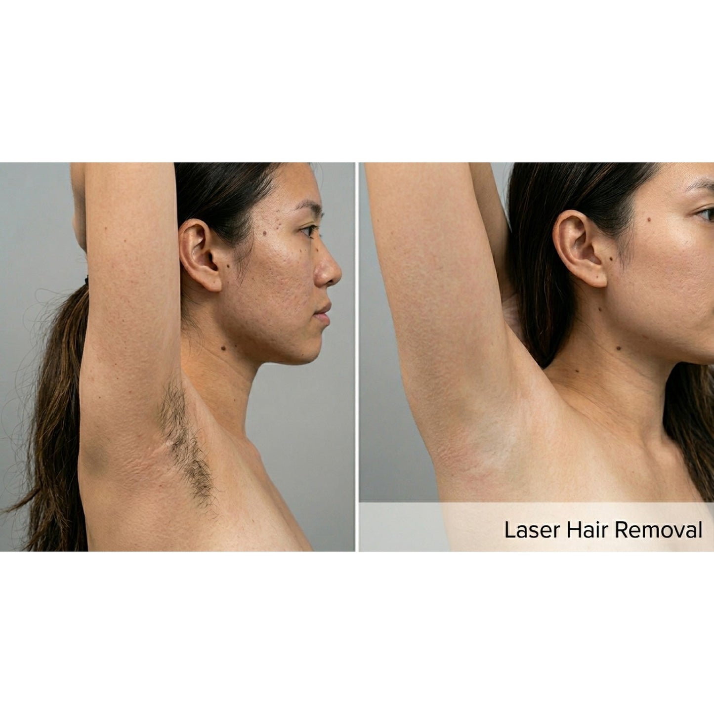 Kavvia DermaLux Diode Laser image 4