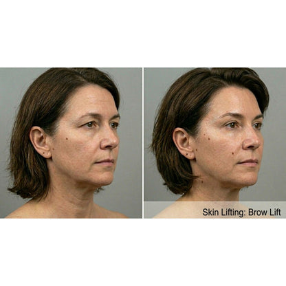 Kavvia Contour X HIFU Body Cavitation System image 3