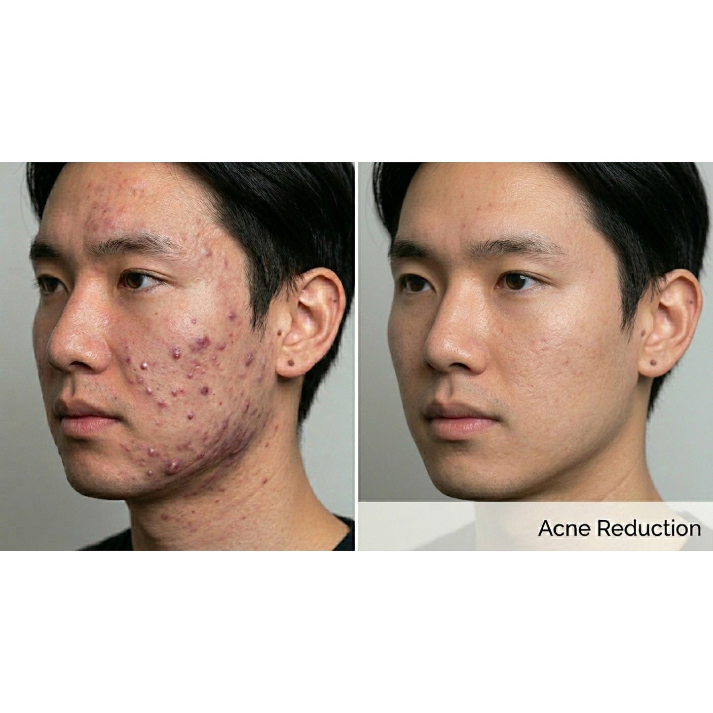 Kavvia Dualis X ND:YAG Laser image 4