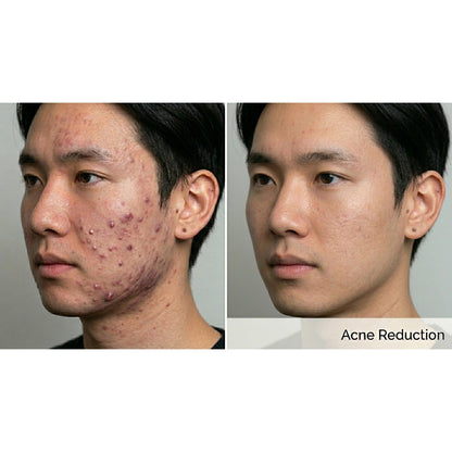 Kavvia Dualis X ND:YAG Laser image 4