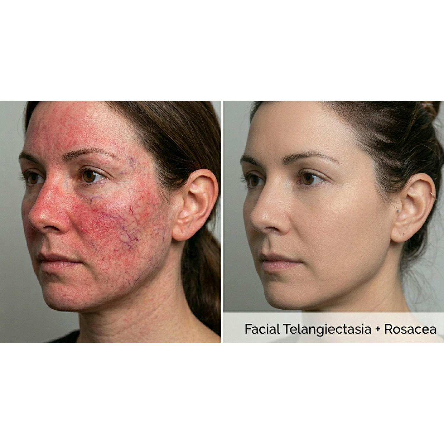 Kavvia Dualis X ND:YAG Laser image 6