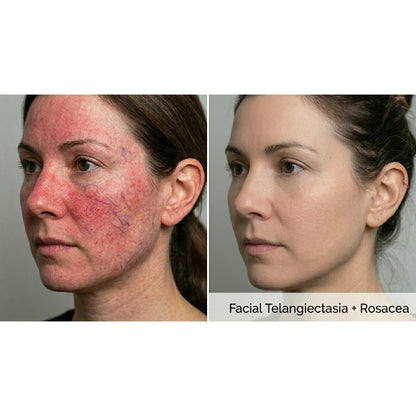 Kavvia Dualis X ND:YAG Laser image 6