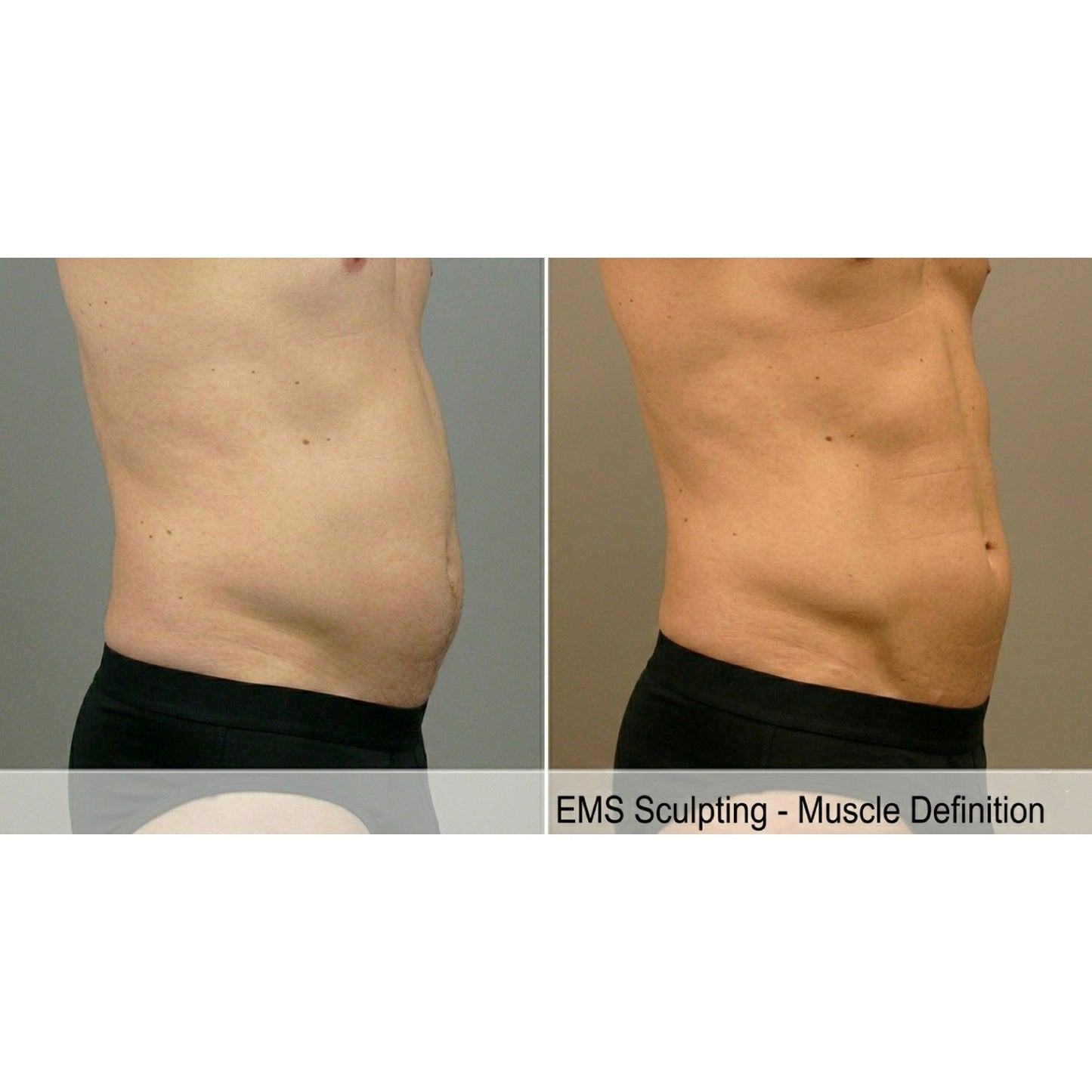 Kavvia Tone Wave EMS Body Sculpting System image 3