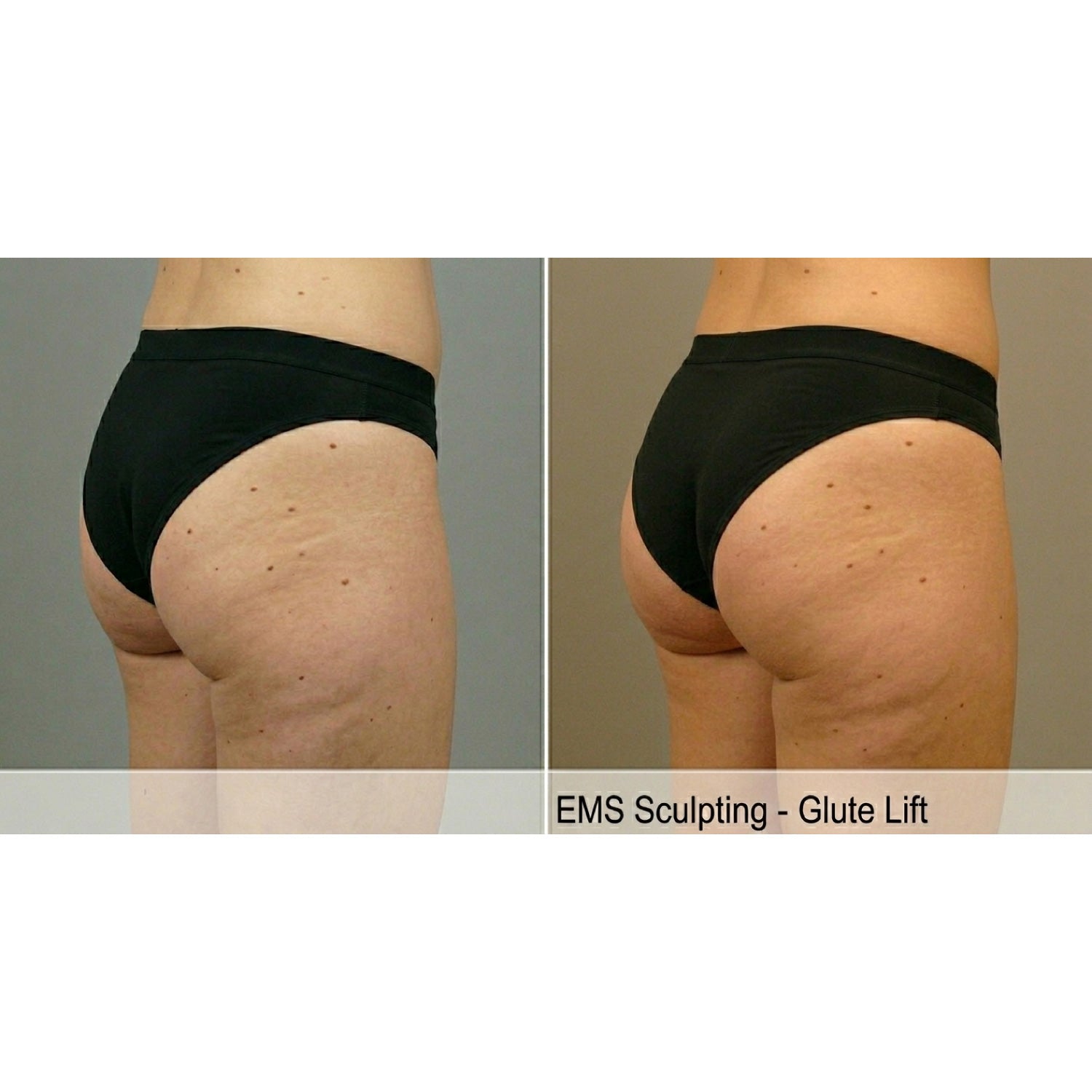 Kavvia Tone Wave EMS Body Sculpting System image 4