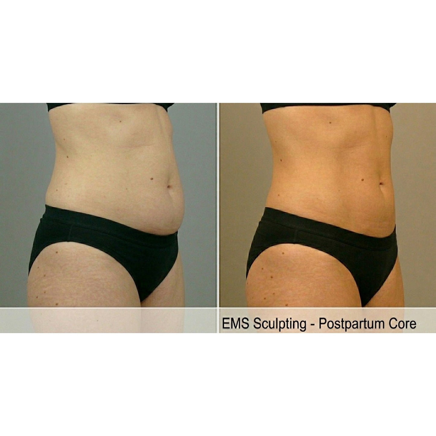 Kavvia Tone Wave EMS Body Sculpting System image 5